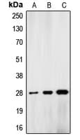 LMNA / Lamin A+C Antibody (Internal)