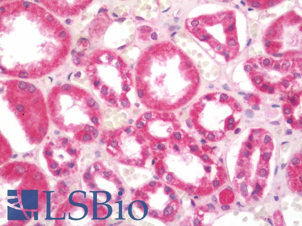 IHC-plus™ Polyclonal Rabbit anti-Human MAPT / Tau Antibody (IHC, WB)