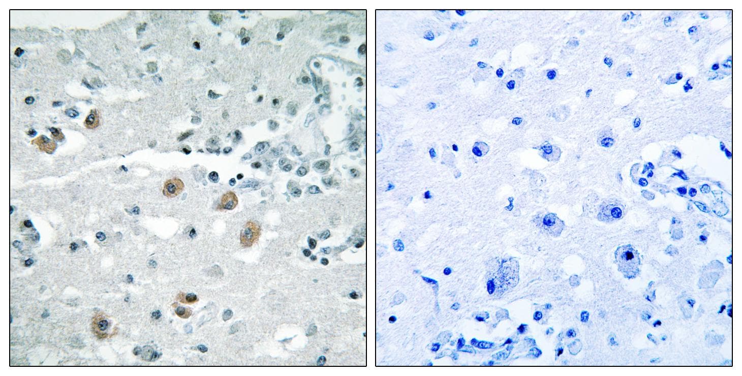Polyclonal Rabbit anti-Human PLA2G4D Antibody (IHC)