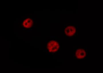 TOP2B / Topoisomerase II Beta Antibody