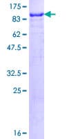 Human SP100 Protein (Recombinant GST)