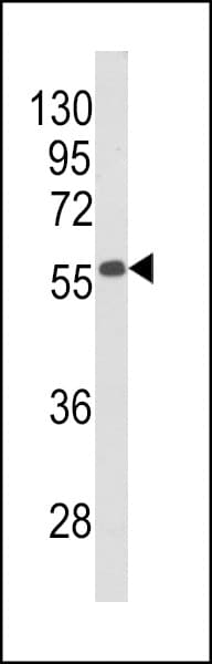 Polyclonal Rabbit anti-Human BECN1 / Beclin-1 Antibody (aa95-132, IHC, WB)