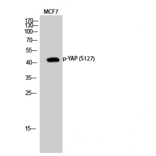 Polyclonal Rabbit anti-Human YAP / YAP1 Antibody (70-150 aa, IHC, WB)