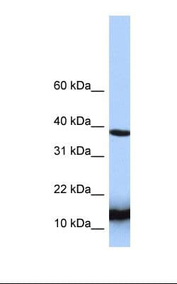 HINT / HINT1 Antibody (N-Terminus)