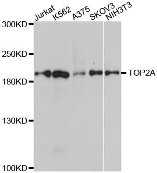 Polyclonal Rabbit anti-Human TOP2A / Topoisomerase II Alpha Antibody (IHC, IF, WB)