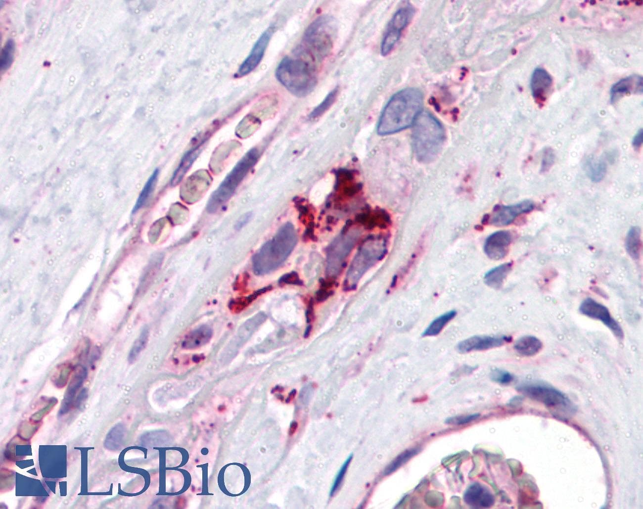 PathPlus™ Polyclonal Rabbit anti-Human PLIN2 / ADFP / Adipophilin Antibody (IHC, WB)