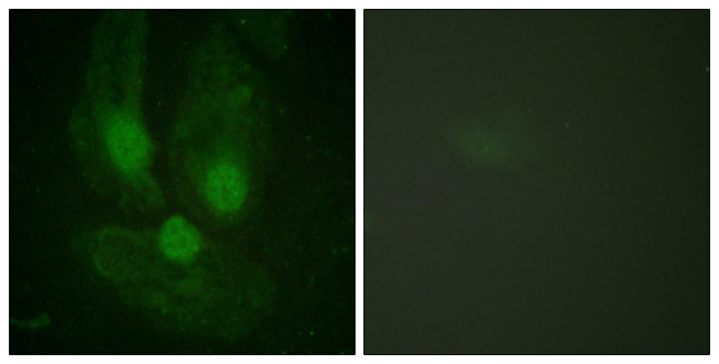 IHC-plus™ Polyclonal Rabbit anti-Human PRKCZ / PKC-Zeta Antibody (aa376-425, IHC, IF, WB)