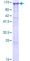 Human GANAB / Alpha Glucosidase II Protein (Recombinant GST)