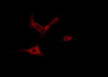 Polyclonal Rabbit anti-Human AOX1 / Aldehyde Oxidase Antibody (IHC, IF, WB)