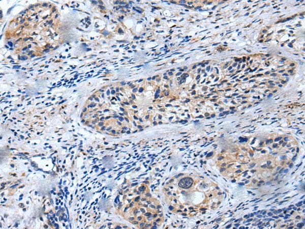 LILRB5 / LIR8 Antibody