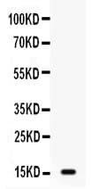 Gastric Inhibitory Peptide Antibody