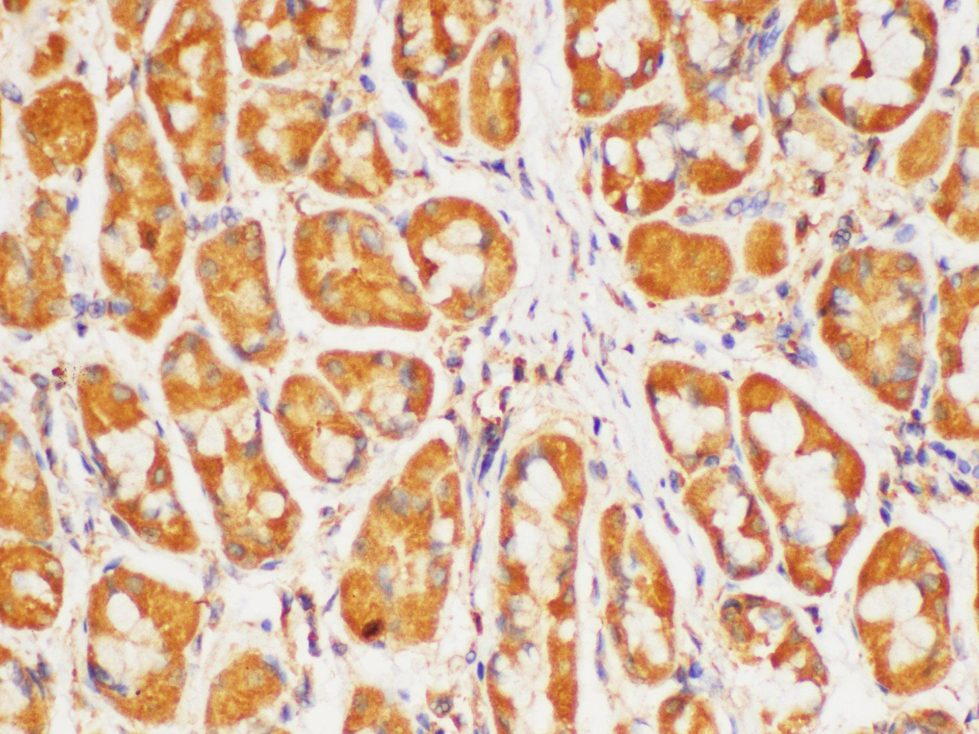 HRAS / H-Ras Antibody