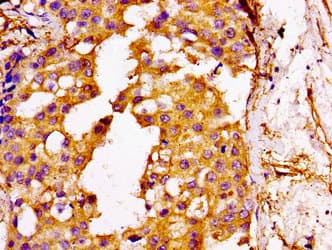 Polyclonal Rabbit anti-Human GGCX Antibody (IHC)