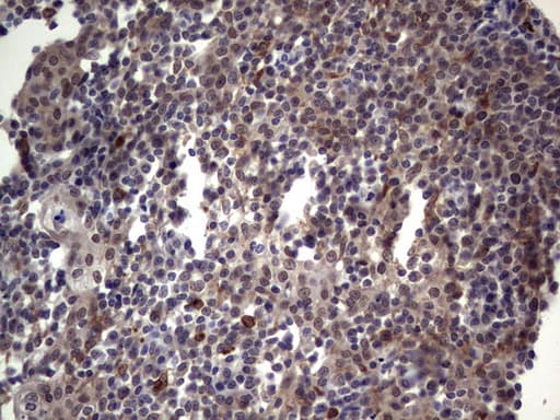 LCX / TET1 Antibody (aa1-305, clone OTI8G6)