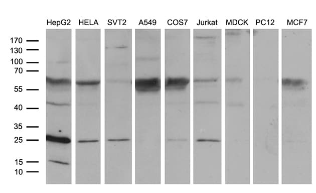 TCEANC2 Antibody (clone OTI2E11)