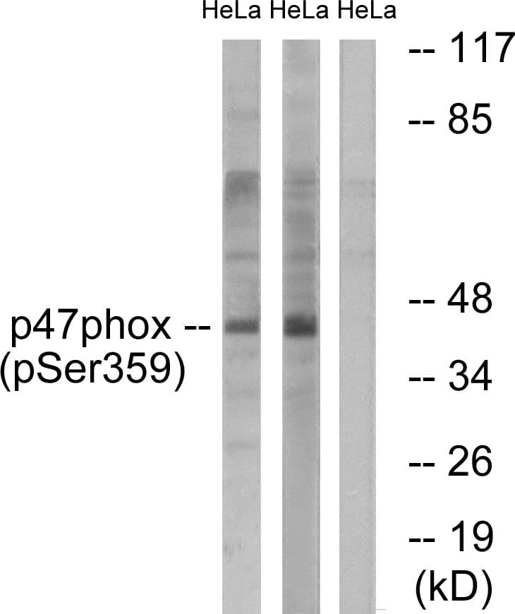 Polyclonal Rabbit anti-Human NCF1 / p47phox / p47 phox Antibody (phospho-Ser359, IHC, IF, WB)