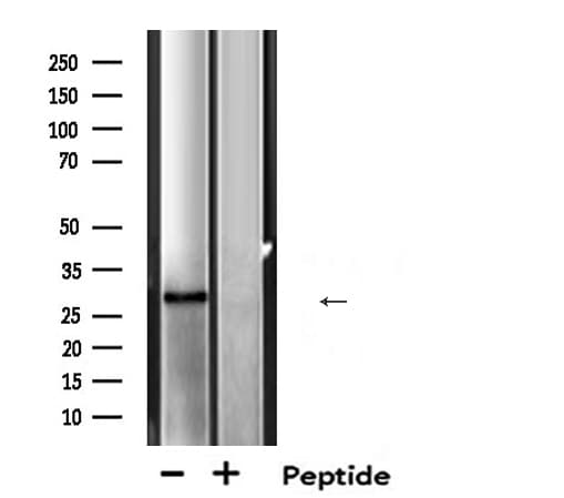 MTAP Antibody