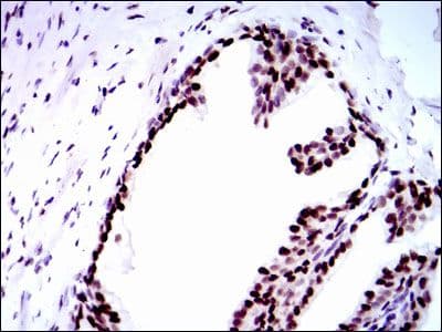 RPA70 / RPA1 Antibody (clone 4C4)