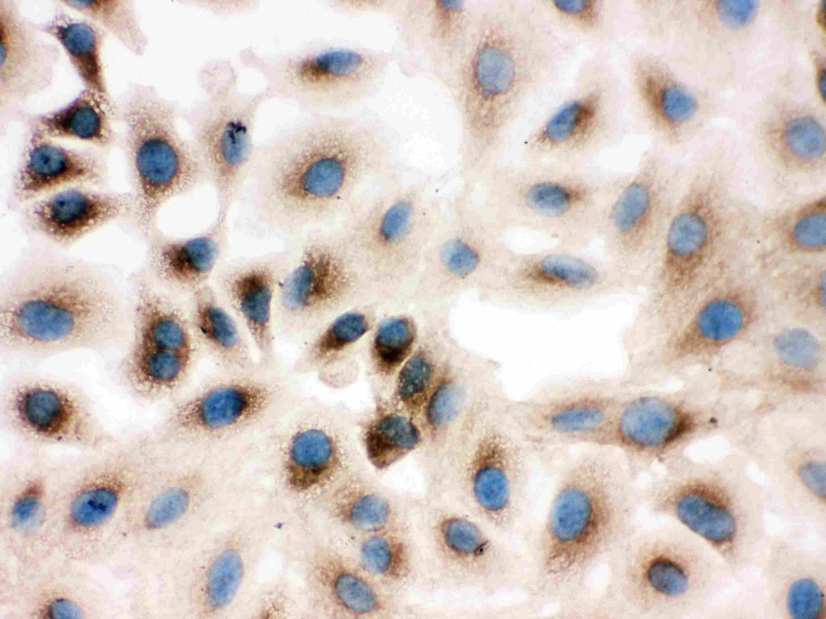 Prohibitin 2 / PHB2 Antibody (aa111-128)