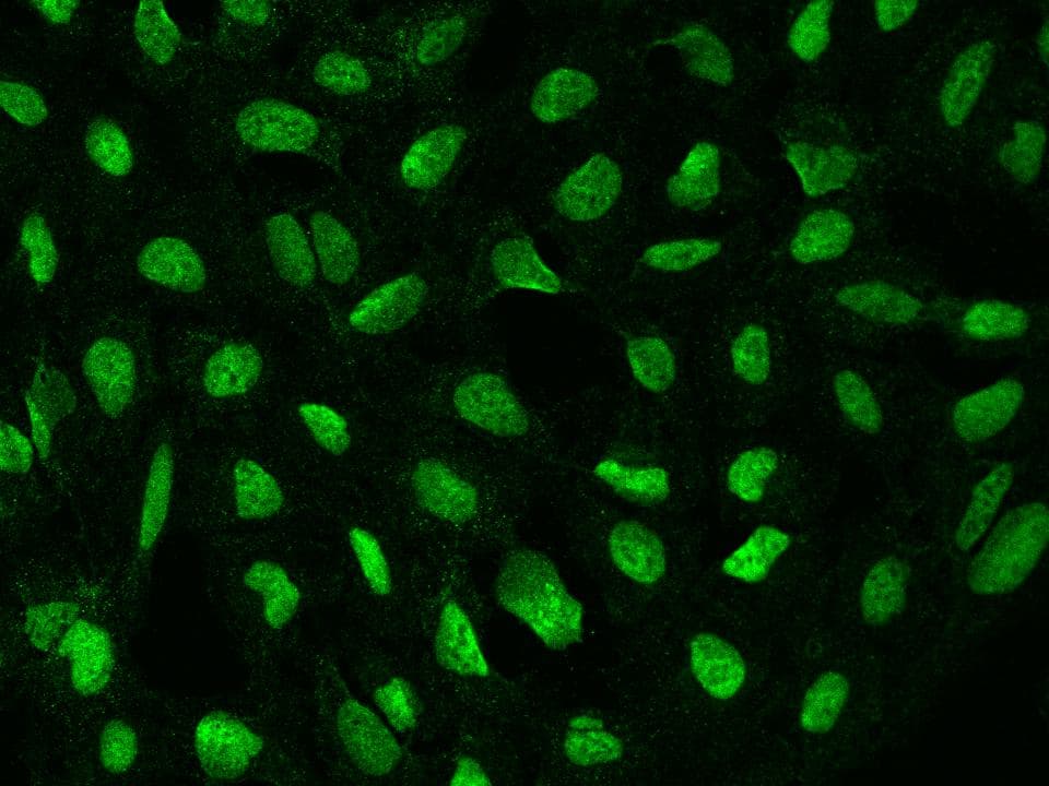 POLR2A / RNA polymerase II Antibody