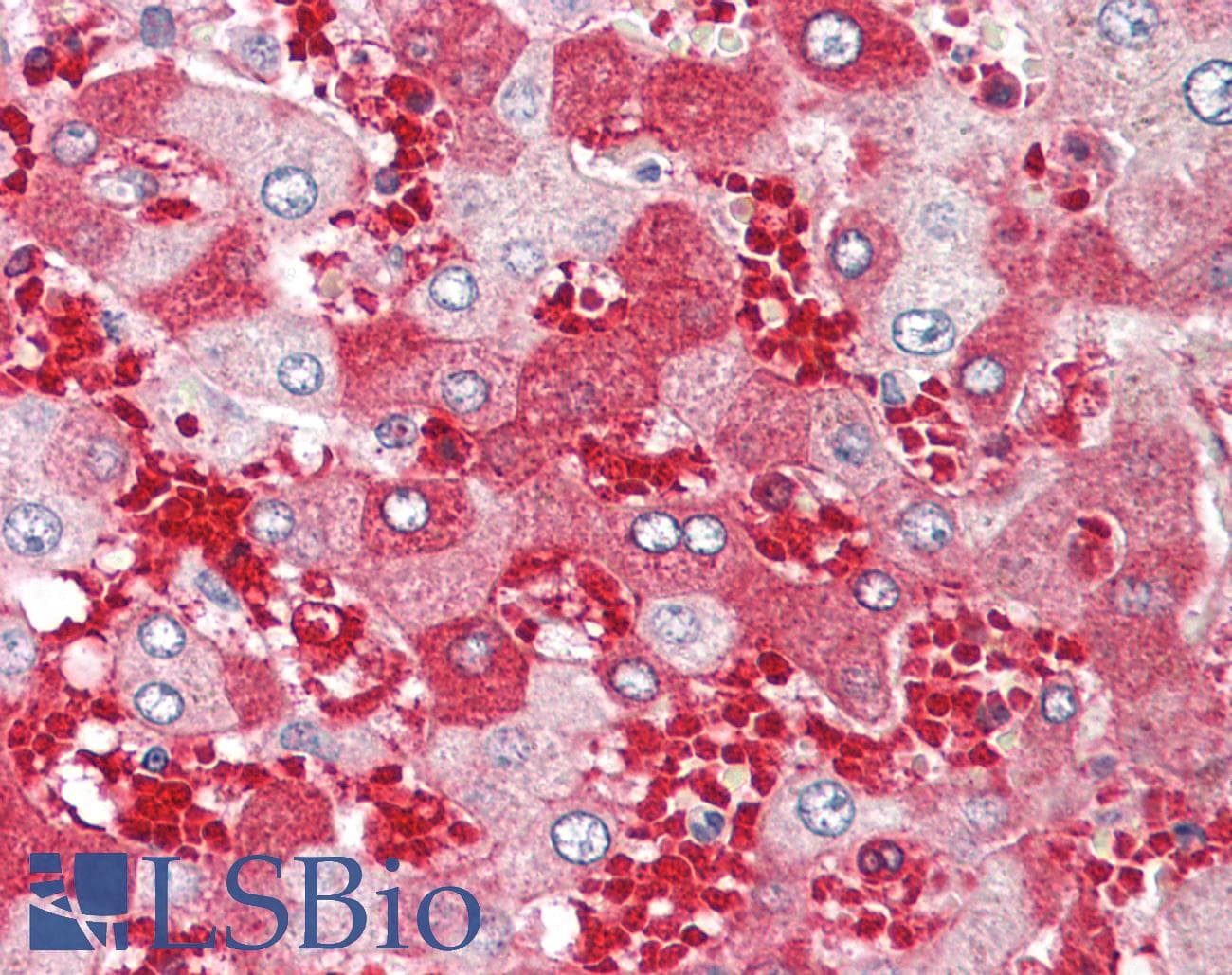 IHC-plus™ ABHD12B Antibody (aa281-330)