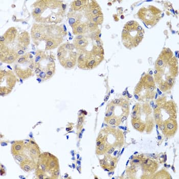 RHOB Antibody