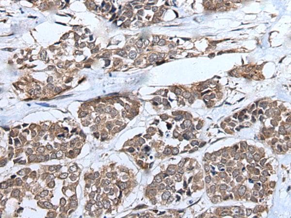 UFD2A / UBE4B Antibody