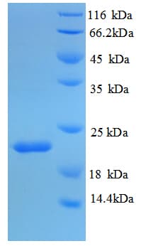 Mouse IL18BP Protein (Recombinant 6His, N-terminus)