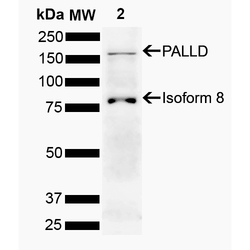 PALLD / Palladin Antibody (PerCP)