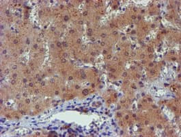 PGM3 Antibody (clone OTI1A11)