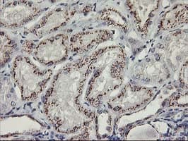 KCNJ3 / GIRK1 Antibody (clone OTI1G3)