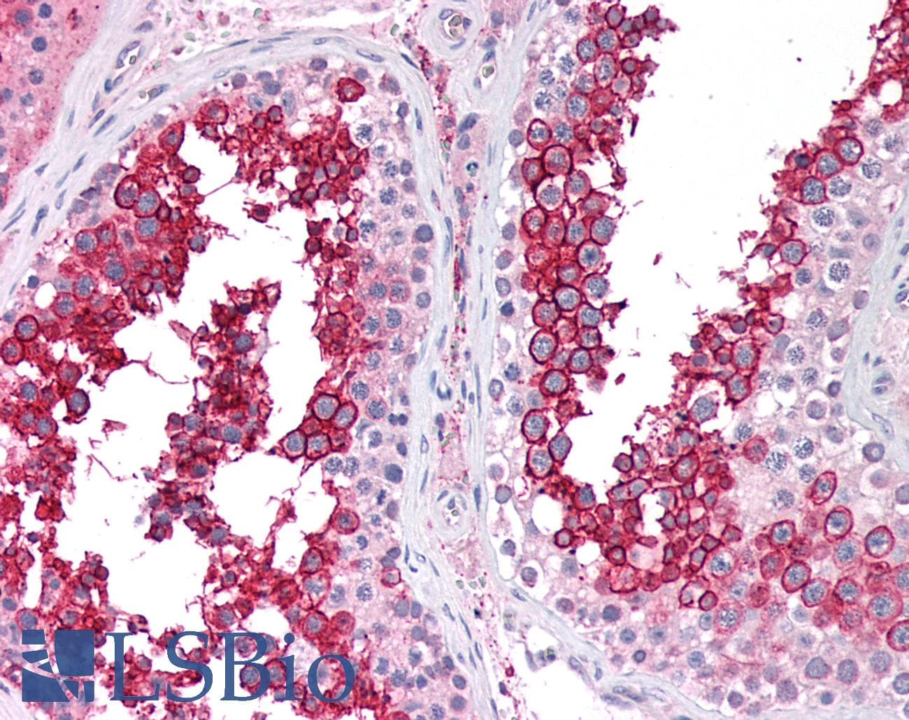 SLC2A3 / GLUT3 Antibody