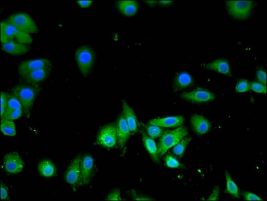 SLC13A5 Antibody