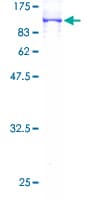 Human NDUFS1 Protein (Recombinant GST)