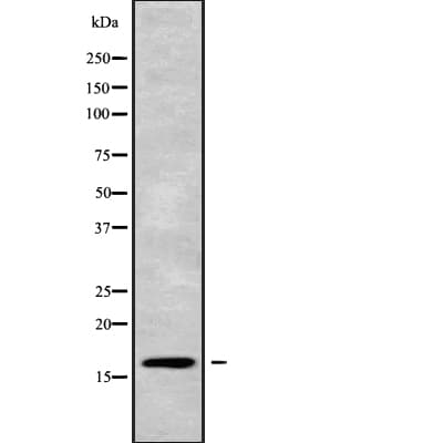 CST5 Antibody