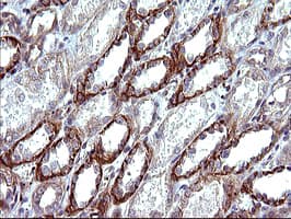 IHC-plus™ TUBB1 / Tubulin Beta 1 Antibody (clone 4A3)