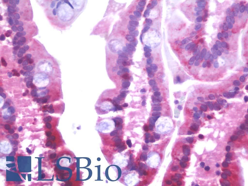 IHC-plus™ SLC6A19 Antibody