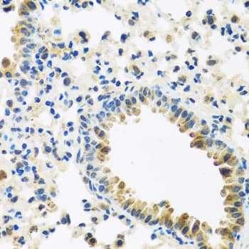 IL28B Antibody