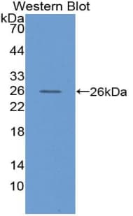 MAP1L / MAP1A Antibody (aa2552-2759, Cy3)