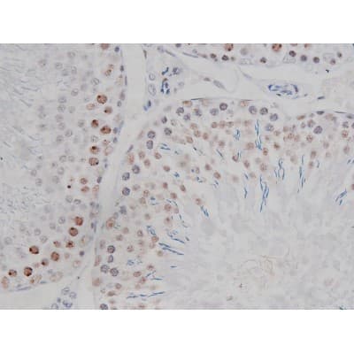 Polyclonal Rabbit anti-Human CHUK / IKKA / IKK Alpha Antibody (phospho-Ser180,phospho-Ser181, IHC, IF, WB)