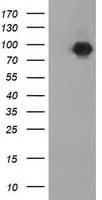 CTNNB1 / Beta Catenin Antibody (clone OTI12H7)