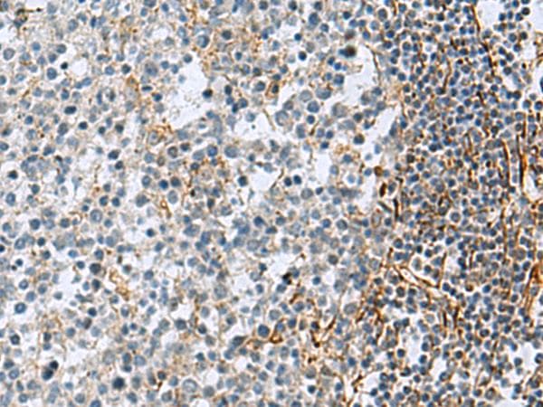 GLS / Glutaminase Antibody