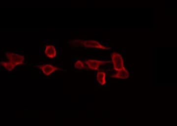 RAB11FIP4 / RAB11-FIP4 Antibody