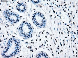 BRAF / B-Raf Antibody (clone OTI4C11)