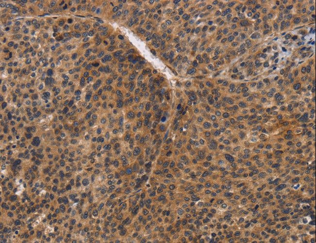 CDC34 Antibody