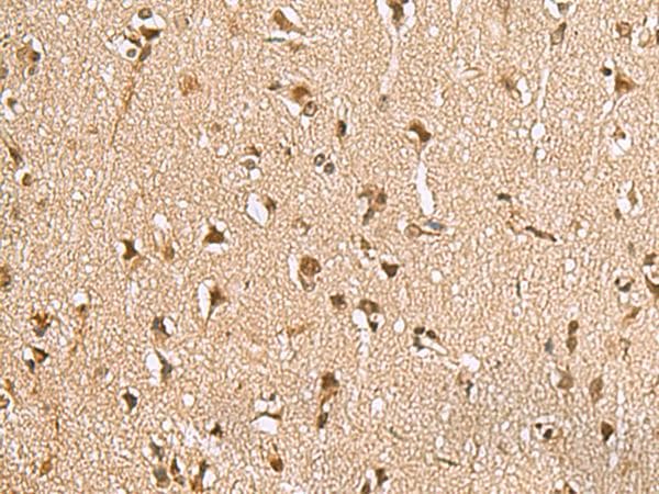 NVL Antibody