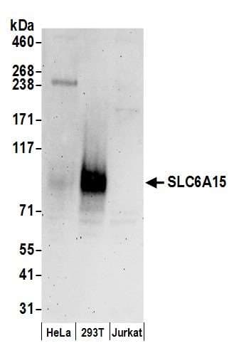 SLC6A15 / SBAT1 Antibody (aa653-703)