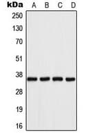 AKR1B1 / Aldose Reductase Antibody (C-Terminus)