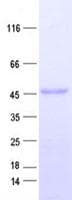 Human HSPC304 / C7orf64 Protein (Recombinant His, N-Terminal)