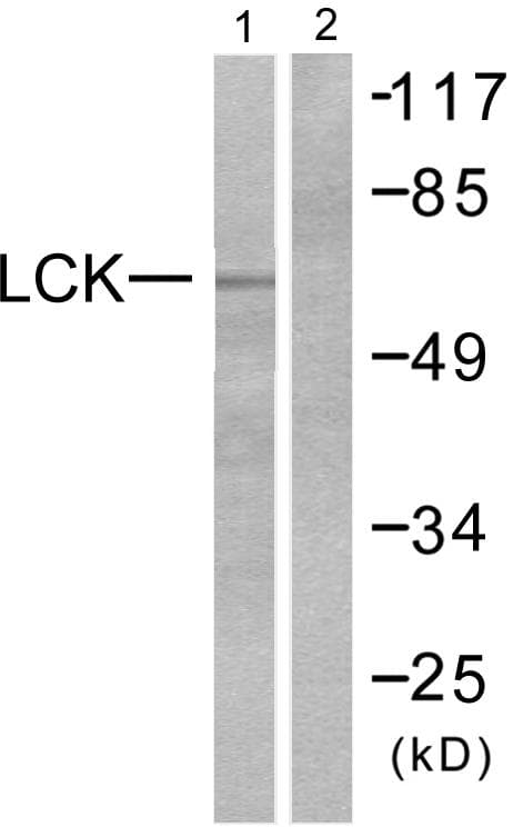 p56lck / LCK Antibody (p393)